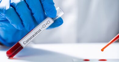 Casos de coronavirus en RD aumentan a 6,972 con un total de 301 personas fallecidas