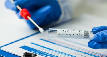 Primera semana del 2023 RD registra 342 casos de covid; 61 nuevos contagios
