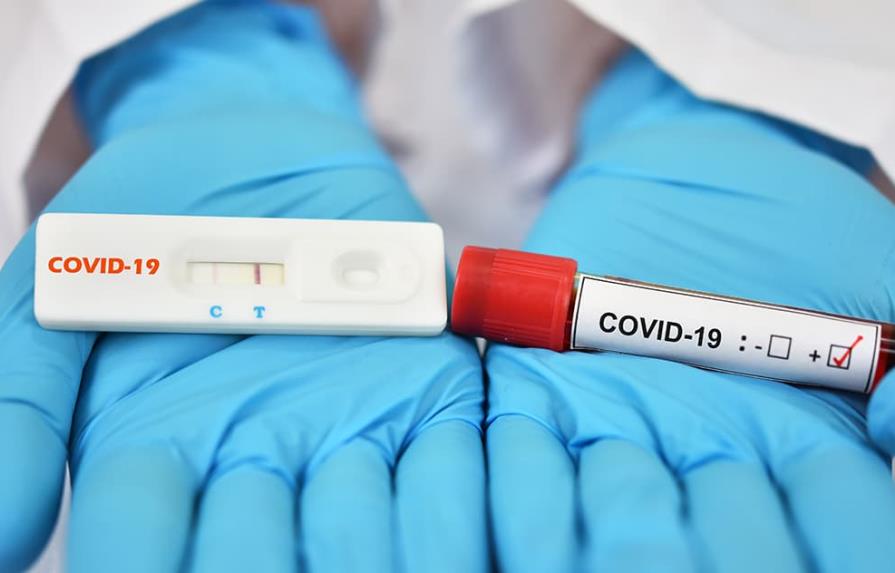 Salud reporta 342 casos activos de COVID-19