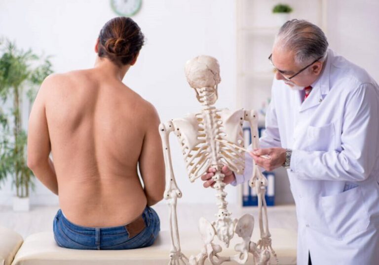 ¿Qué es la escoliosis y qué causa? Esto dicen los expertos