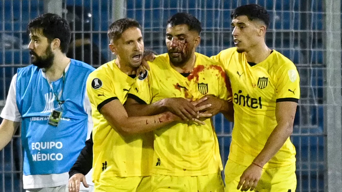 Fuerte pedrada en la cara deja sangrado a un futbolista en un partido de Copa Libertadores