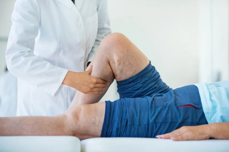 La terapia trombolítica está a disposición en 30 hospitales