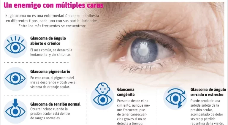 El glaucoma es el ladrón silencioso de la visión que amenaza a millones