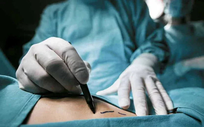 Más del 80 % de pacientes mejoran su autoestima tras una cirugía estética, según especialista