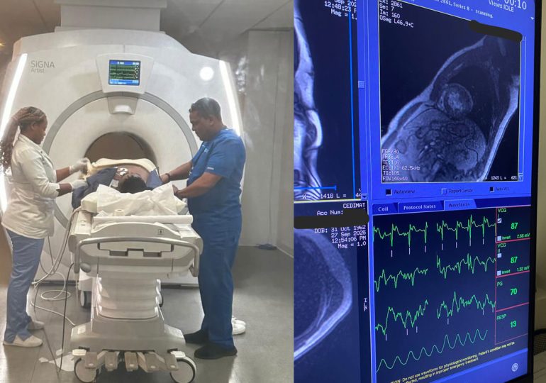 Realizan primera resonancia cardíaca de estrés en la RD