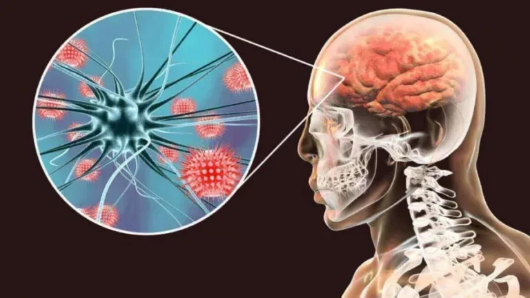 Ojo con la meningitis
