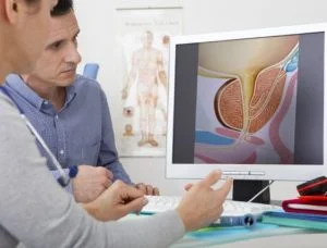 Cáncer próstata conmemora su día con altas tasas curaciones