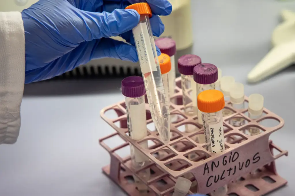 Investigadores trabajan en el desarrollo de una terapia génica para prevenir el alzhéimer