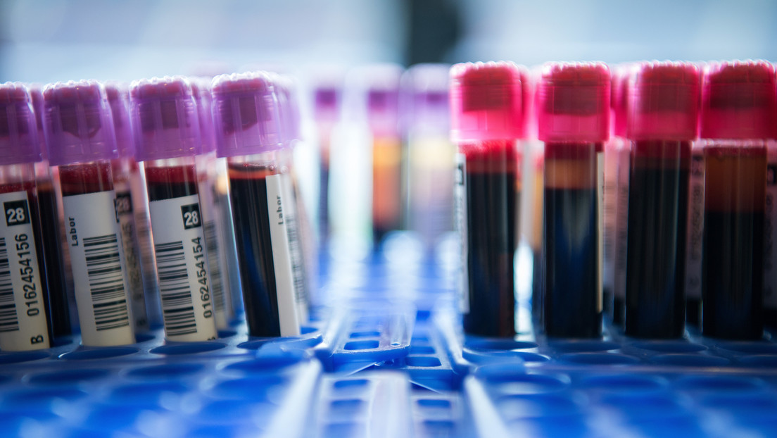 La clave para predecir la supervivencia tras un infarto podría estar en una sencilla prueba de sangre