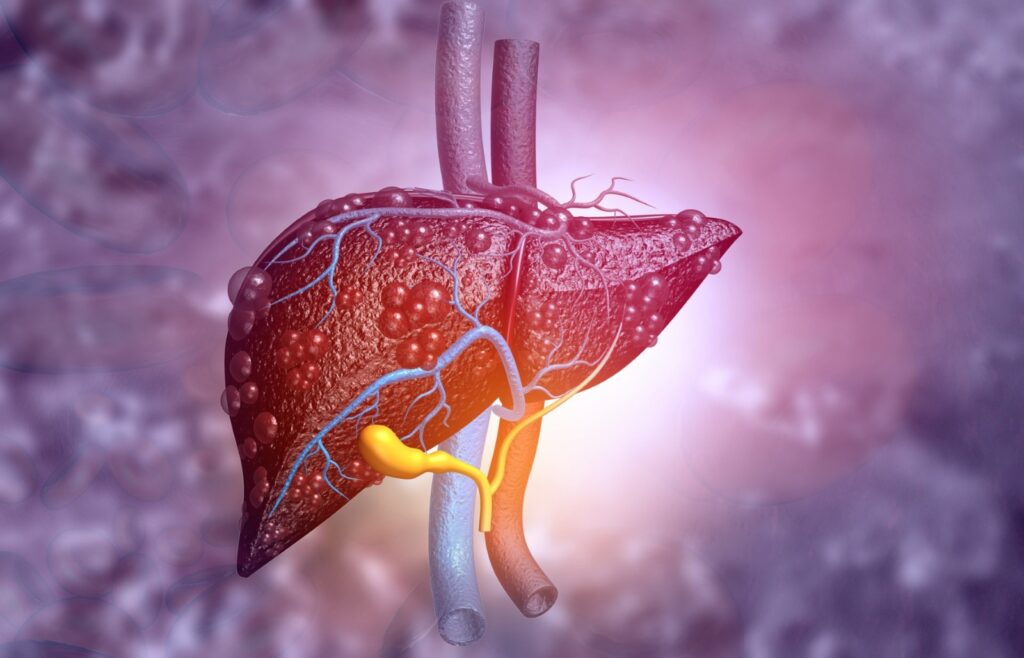 Hepatitis C, una infección que puede curarse en más del 95% de los casos