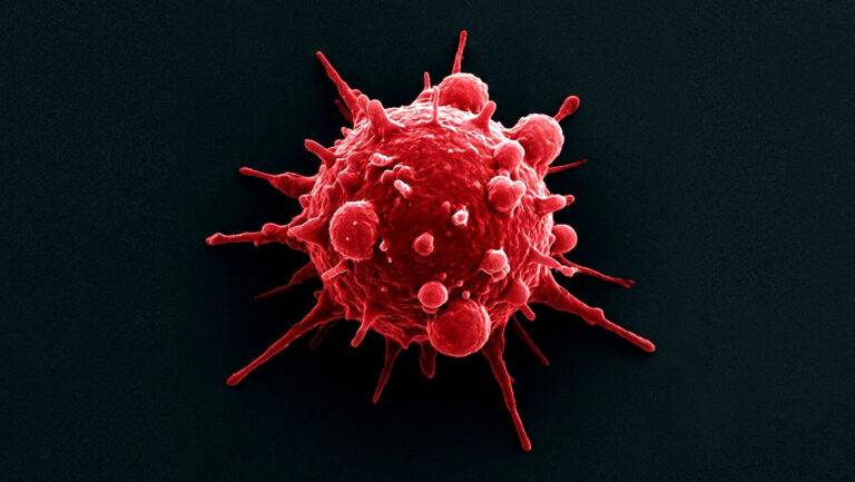 Estas profesiones figuran entre las más golpeadas por el cáncer ligado a la radiación