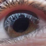 Retinosis pigmentaria en RD: Las señales en la visión que no deberían pasarse por alto